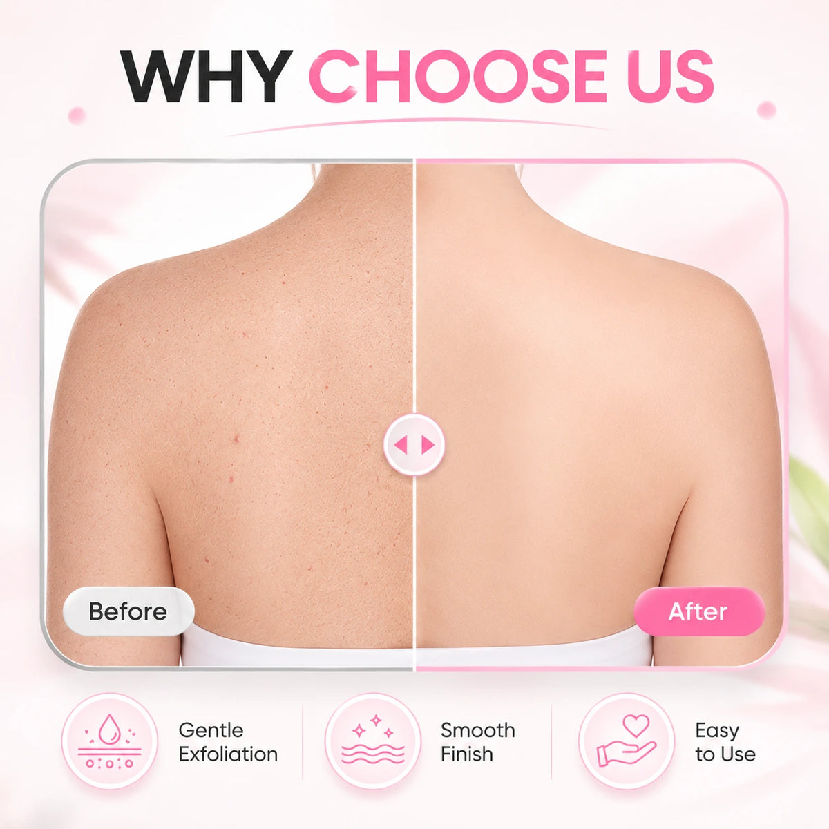 Soft Rubber Shower Scrubber | Gentle Body Exfoliator | Buy 2 Get 2 Free🔥