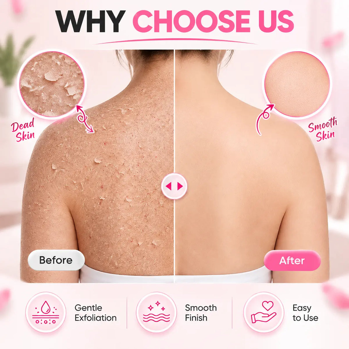 Soft Rubber Shower Scrubber | Gentle Body Exfoliator | Buy 2 Get 2 Free🔥